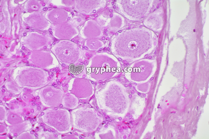 Ganglion rachidien x100 - gryphea.com